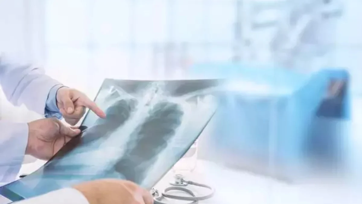 Zatürre Nedir? belirtileri, Bulaşma Yolları ve Tedavi Yöntemleri