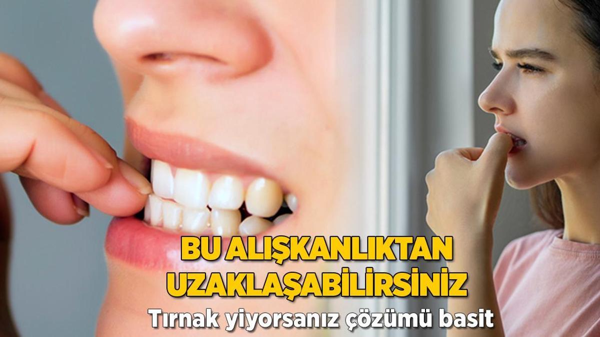 Bu alışkanlıktan uzak durun! Tırnak yiyorsanız çözümü basit, hemen sürün