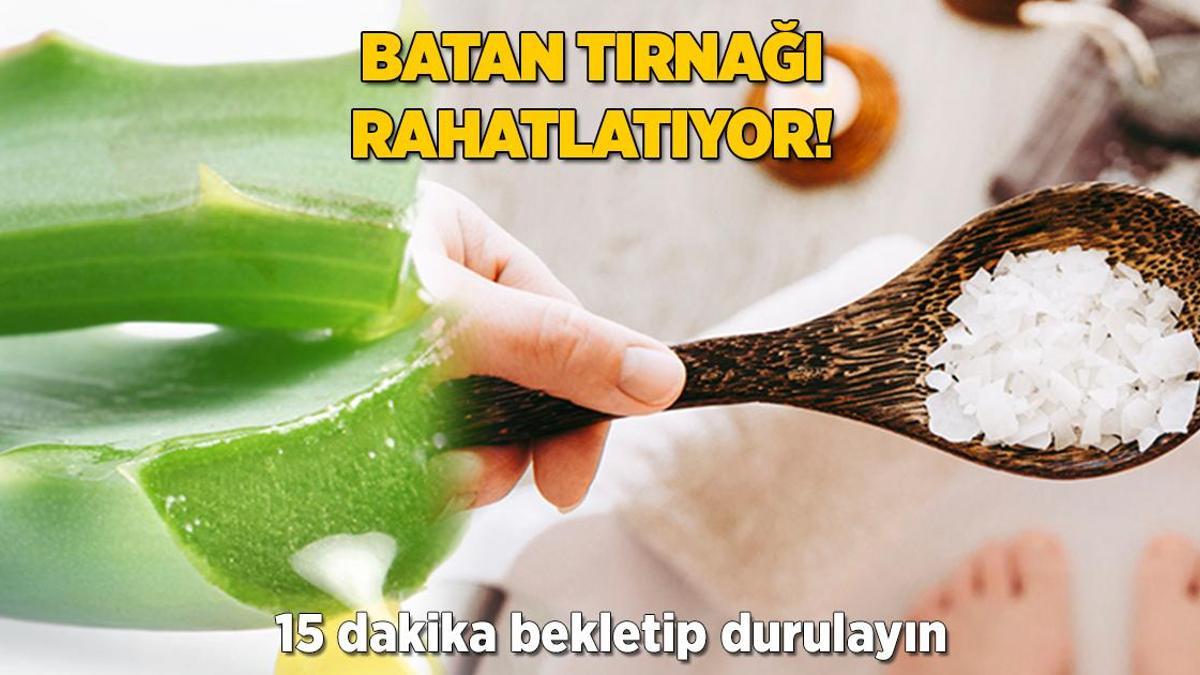 Ete batan tırnağı kurtarıyor! 15 dakikada çözüm, işin sırrı azıcık pamukta