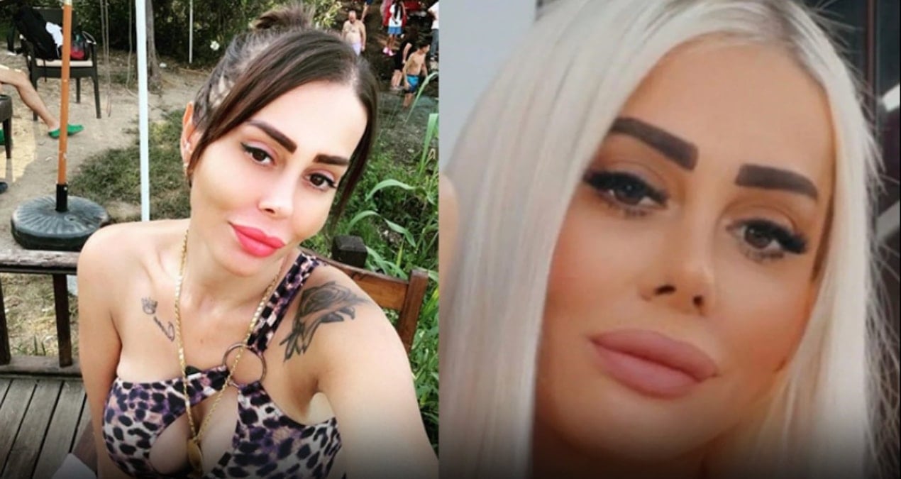 Güzellik uğruna can verdi