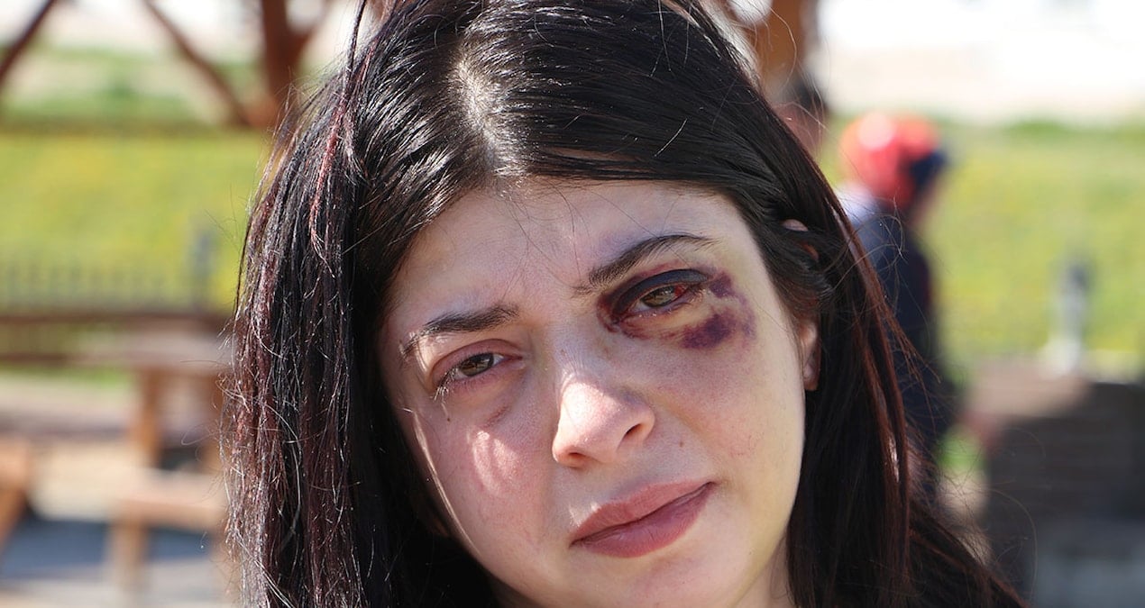 Nasıl bir döneme denk geldik: Genç kadını ‘etek giydiğine göre ücretin ne kadar?’ diyerek dövdü