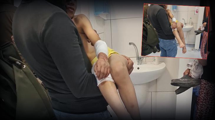 Sokakta Oynarken Başıboş Köpeklerin Saldırısına Uğradı