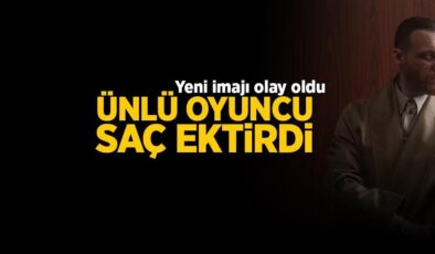 Kerem Bürsin Saç Ektirdi: Yeni İmajı Çok Konuşuldu