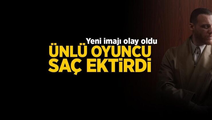 Kerem Bürsin Saç Ektirdi: Yeni İmajı Çok Konuşuldu
