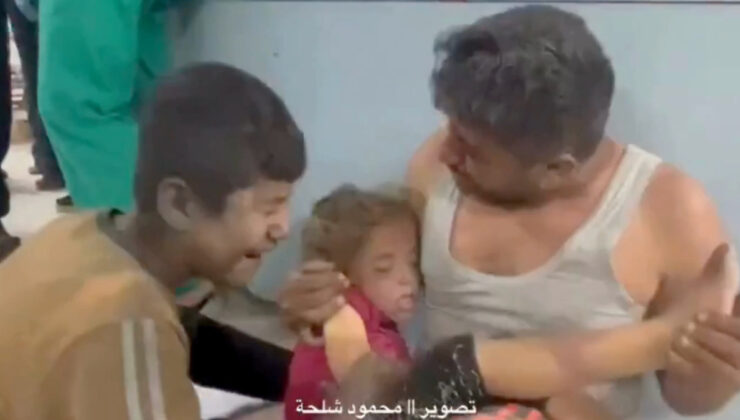 Küçük Kızını Son Kez Öpen Acılı Baba Yürekleri Dağladı