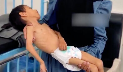 Gazze’de bir çocuk daha yetersiz beslenme nedeniyle yaşam savaşı veriyor