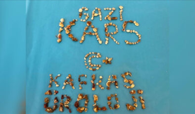 Kars’ta hastanın iki böbreğinden 300’ün üzerinde taş çıktı