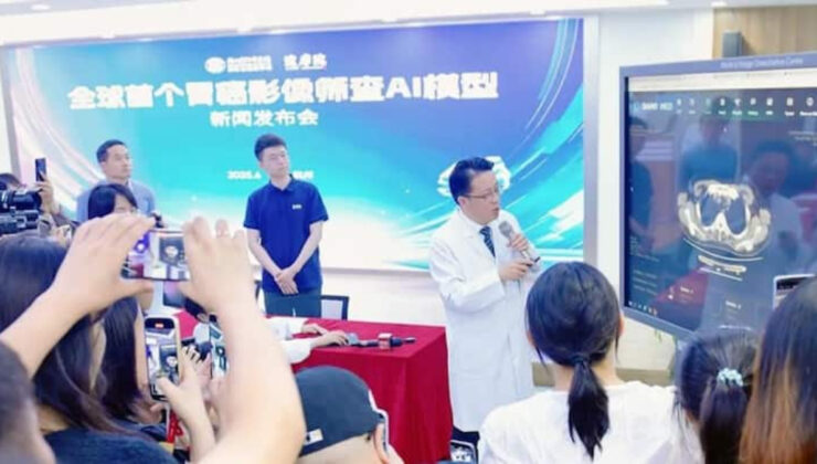 Alibaba’nın yeni yapay zekası mide kanserini erken evrelerde tespit edebiliyor