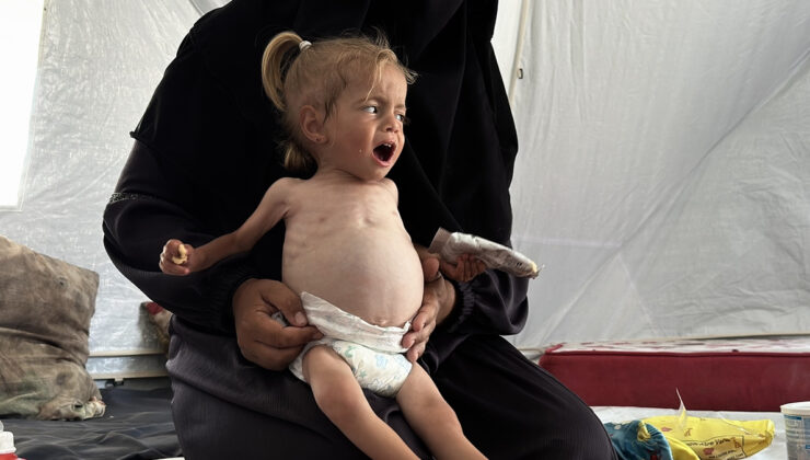 Gazze’de 2 yaşındaki Filistinli bebek yaşam mücadelesi veriyor