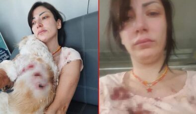 Genç kadın kan içinde kaldı! ‘Bacağımın arkasını parçaladılar’