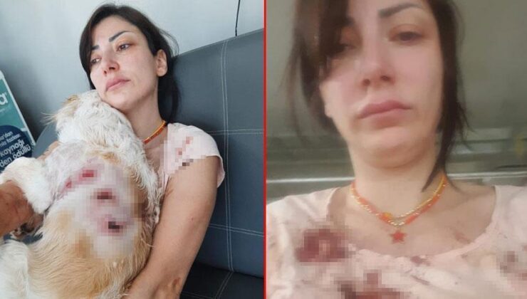 Genç kadın kan içinde kaldı! ‘Bacağımın arkasını parçaladılar’