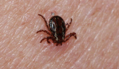 KKKA hastalığında ölüm oranı yüzde 5’in altında