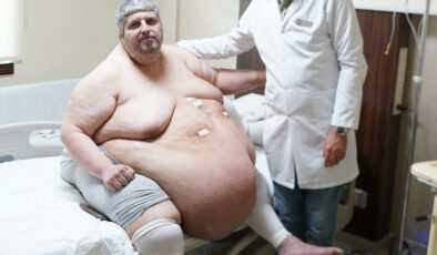 Denizli’de 310 kiloluk hasta sedyede geldiği hastaneden yürüyerek çıktı