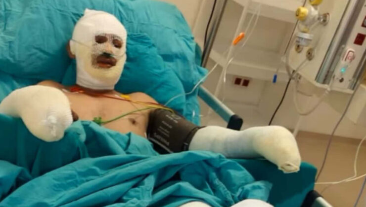 Eskişehir’deki orman yangınına müdahale ederken ağır yaralanan eşini paylaştı