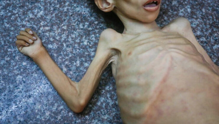 Gazze’de 147 kişi açlıktan öldü