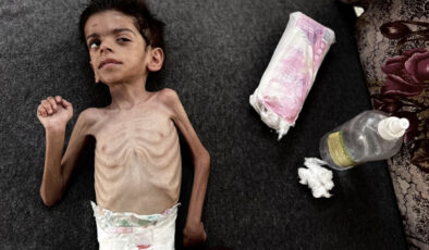 Gazze’de açlıktan ölümler sürüyor