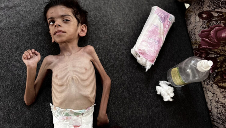 Gazze’de açlıktan ölümler sürüyor