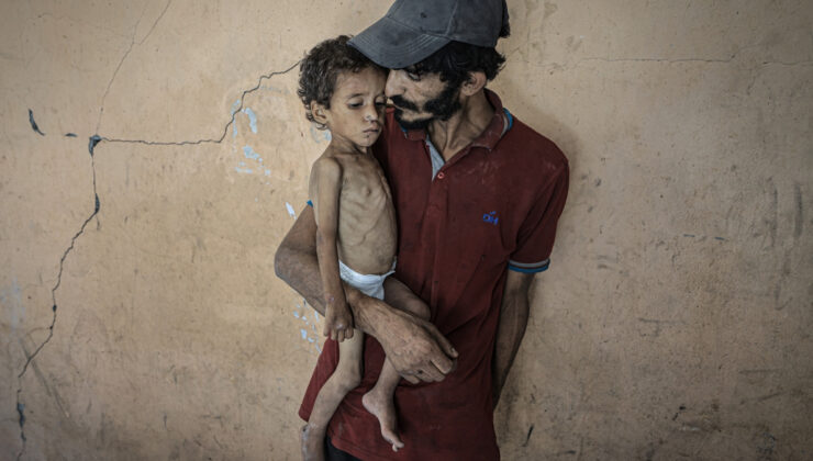 Gazze’de çocuklar açlıkla mücadele ediyor