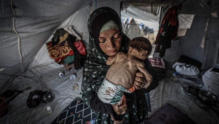 Gazze’de açlıktan ölenlerin sayısı artıyor