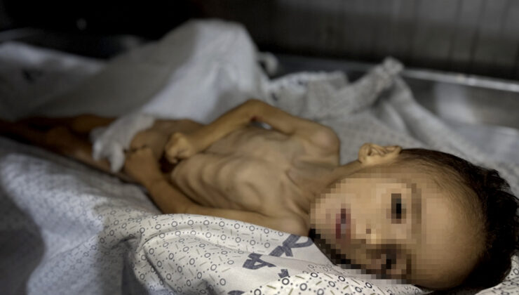 Gazze’de bir bebek daha açlıktan öldü