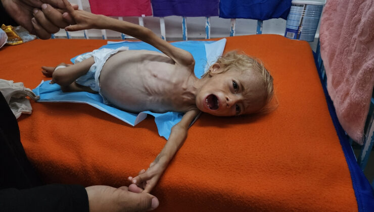 Gazze’de çocuklar açlıkla savaşıyor