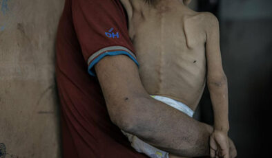 İsrail’in politikaları Gazze’de kıtlığı derinleştirdi