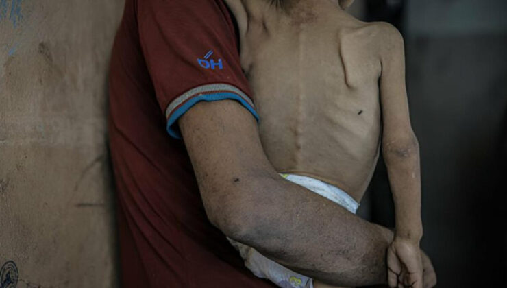 İsrail’in politikaları Gazze’de kıtlığı derinleştirdi