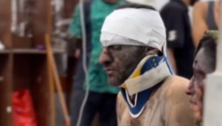 Gazze’de el ele tutuşan çiftin hayatta kalma mücadelesi