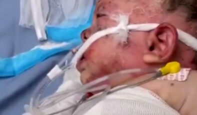 İsrail zulmünün utanç karesi: Gazze’de 10 aylık bebek ağır yaralandı