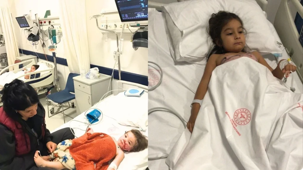 Ankara Etimesgut’ta Pitbull Dehşeti İki Kardeş Yaralandı