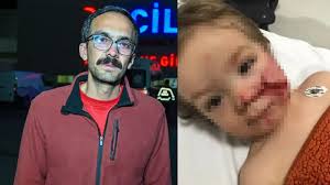 Ankara’da Pitbull Dehşeti: İki Çocuğun Yüzü ve Göğsü Parçalandı