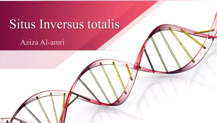 Situs İnversus Totalis Nedir?