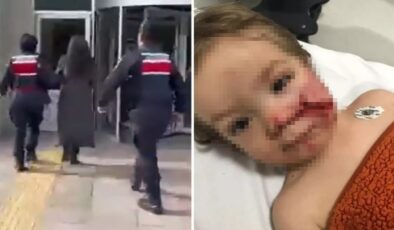 Ankara’da 2 Kardeşe Saldıran Pitbull Vakası: Sahibinin İhmali Kamerada