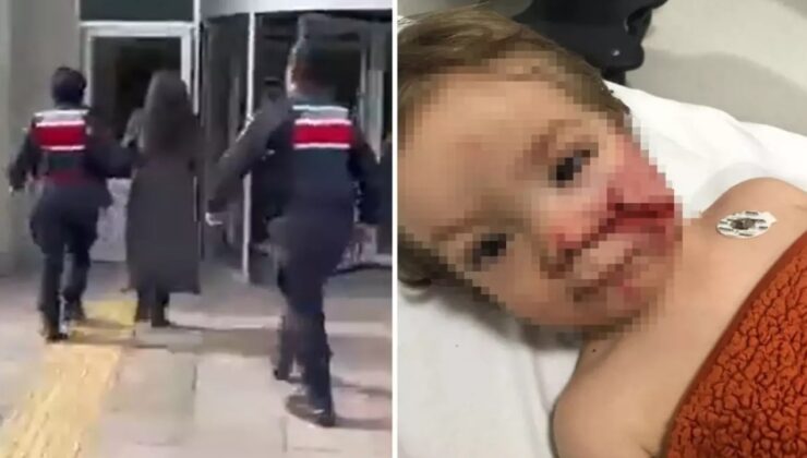 Ankara’da 2 Kardeşe Saldıran Pitbull Vakası: Sahibinin İhmali Kamerada