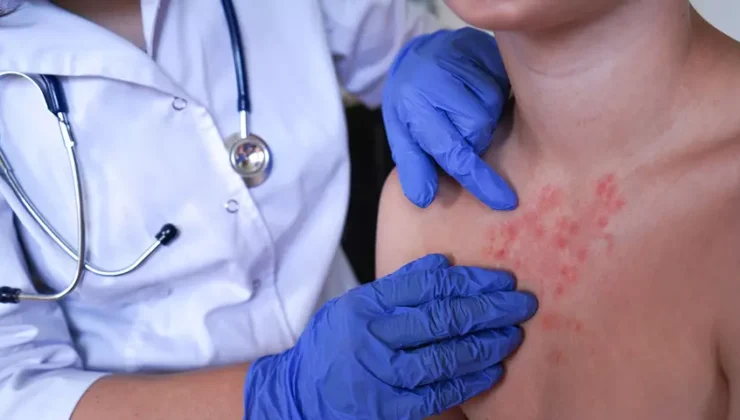 SON DAKİKA: Virüs Evrim Geçiriyor: Rekombinant Varyant Ortaya Çıktı