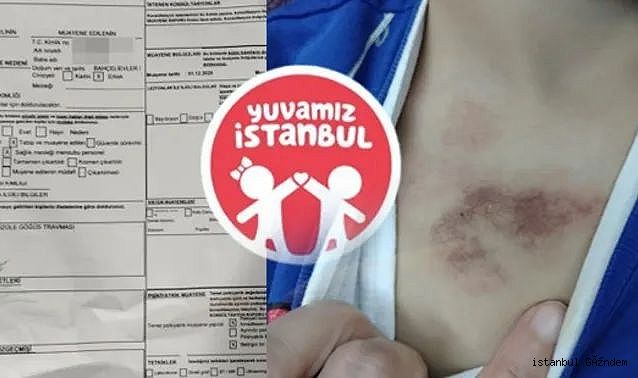 Eyüpsultan İBB kreş istismar iddiaları