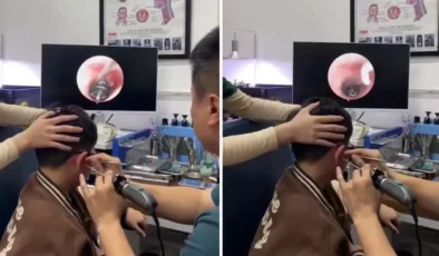 Kulak Ağrısı Diye Gitti, Gerçek Herkesi Şoke Etti: Doktorlar Bile Gözlerine İnanamadı