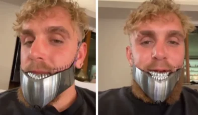 Jake Paul İkinci Kez Ameliyat Oldu: Çene Kırığı Nedeniyle Aylardır Sıvıyla Besleniyor