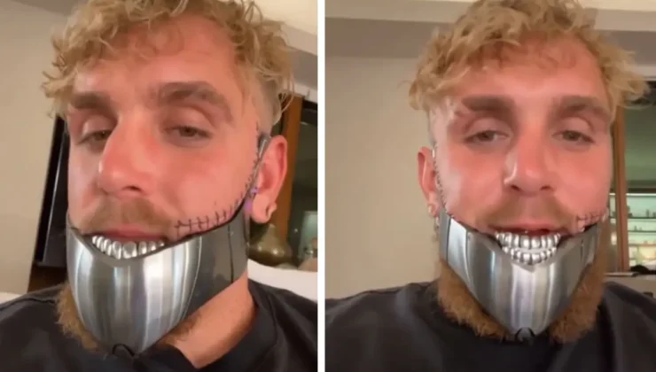 Jake Paul İkinci Kez Ameliyat Oldu: Çene Kırığı Nedeniyle Aylardır Sıvıyla Besleniyor