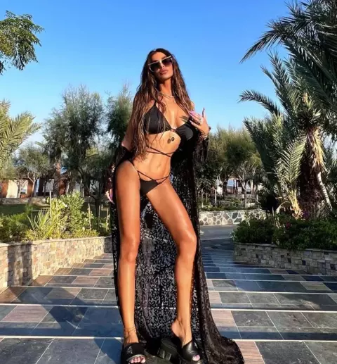 Tuğçe Özbudak estetik değişimi