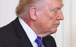 Trump’ın Sağlık Durumu Bilmecesi: Beyaz Saray’dan Şüphe Uyandıran “Kayıp” Açıklaması