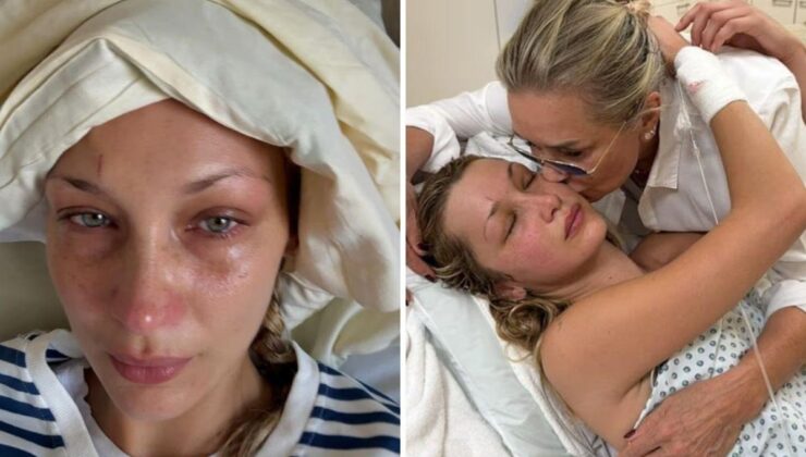 Podyumların Dünyaca Ünlü Yıldızı Bella Hadid Sessizliğini Bozdu: Artık Nefes Bile Alamıyorum!