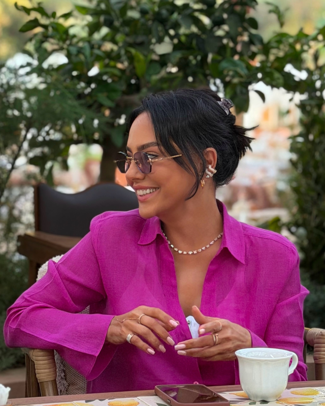 Ebru Gündeş estetik son hali