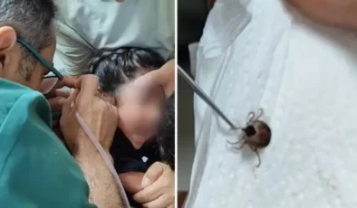 Kulak Ağrısıyla Hastaneye Götürülen Çocuğun Kulağından Canlı Kene Çıkarıldı! Uzmanlardan Ailelere Hayati Uyarı