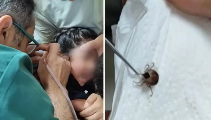 Kulak Ağrısıyla Hastaneye Götürülen Çocuğun Kulağından Canlı Kene Çıkarıldı! Uzmanlardan Ailelere Hayati Uyarı